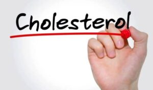 Cholesterol management